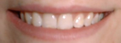 dentist in ryde, isle of wight